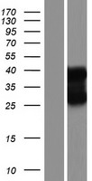 HNRNPCL1 Human Over-expression Lysates NM_001013631