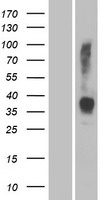 OR2W3 Human Over-expression Lysates NM_001001957