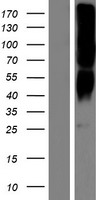 OR2T8 Human Over-expression Lysates NM_001005522