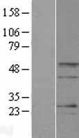 BARHL2 Human Over-expression Lysates NM_020063