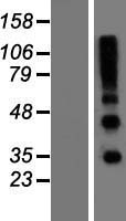 RSPO4 Human Over-expression Lysates NM_001029871