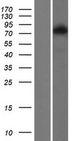 Transglutaminase 6 (TGM6) Human Over-expression Lysates NM_198994