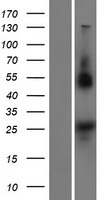 ls344022 noto human over expression lysates nm 001134462 wb testing 1