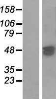 SAMD7 Human Over-expression Lysates NM_182610