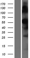 ls344805 tmprss7 human over expression lysates nm 001042575 wb testing 1