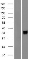 CD200R1L Human Over-expression Lysates NM_001008784