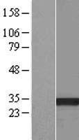 HSD17B13 Human Over-expression Lysates NM_178135