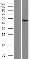 ls345651 actbl2 human over expression lysates nm 001017992 wb testing 1