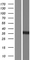 ls345778 mtx3 human over expression lysates nm 001167741 wb testing 1