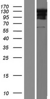 RSPH4A Human Over-expression Lysates NM_001010892