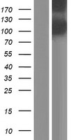 EYS Human Over-expression Lysates NM_001142801