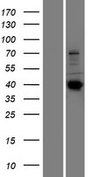 SEPTIN14 Human Over-expression Lysates NM_207366