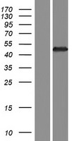 GNAT3 Human Over-expression Lysates NM_001102386