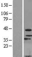 MOGAT3 Human Over-expression Lysates NM_178176