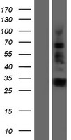 IGFBPL1 Human Over-expression Lysates NM_001007563