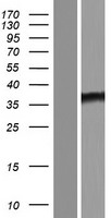 ls347454 ankrd58 sowahd human over expression lysates nm 001105576 wb testing 1