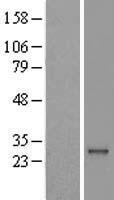 RAB41 Human Over-expression Lysates NM_001032726