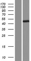 TUBB8 Human Over-expression Lysates NM_001164154