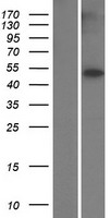TUBB8 Human Over-expression Lysates NM_177987