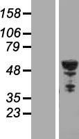TUBB2B Human Over-expression Lysates NM_178012