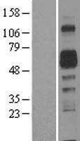 ls347902 amigo2 human over expression lysates nm 001143668 wb testing 1