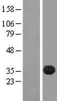 FAM70B (TMEM255B) Human Over-expression Lysates NM_182614