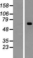 ls348158 acsm2b human over expression lysates nm 182617 wb testing 1