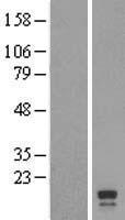 C2orf48 Human Over-expression Lysates NM_182626