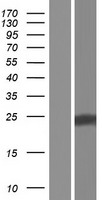 ls348801 lnp1 human over expression lysates nm 001085451 wb testing 1