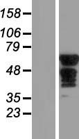 SLC6A18 Human Over-expression Lysates NM_182632