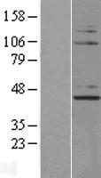 NUP43 Human Over-expression Lysates NM_198887