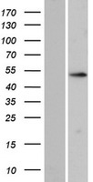 ZNF713 Human Over-expression Lysates NM_182633