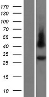GJE1 (GJC3) Human Over-expression Lysates NM_181538