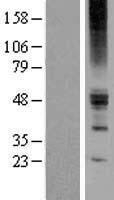 ls353174 lgicz1 zacn human over expression lysates nm 180990 wb testing 1