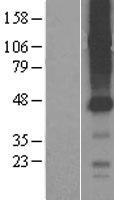 ls353189 slco4c1 human over expression lysates nm 180991 wb testing 1