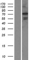 ls353238 padi6 human over expression lysates nm 207421 wb testing 1