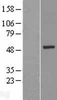 ls353288 krt26 human over expression lysates nm 181539 wb testing 1