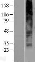 GPR141 Human Over-expression Lysates NM_181791