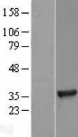 TICAM2 Human Over-expression Lysates NM_021649
