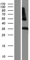 ls353514 lilra5 human over expression lysates nm 181985 wb testing 2
