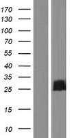 FAM101B (RFLNB) Human Over-expression Lysates NM_182705
