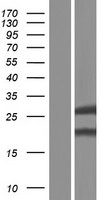 Glutathione S Transferase kappa 1 (GSTK1) Human Over-expression Lysates NM_001143681