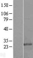 Glutathione S Transferase kappa 1 (GSTK1) Human Over-expression Lysates NM_015917