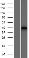 Inactive ubiquitin carboxyl terminal hydrolase 50 (USP50) Human Over-expression Lysates NM_203494