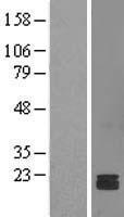 NDUFS7 Human Over-expression Lysates NM_024407