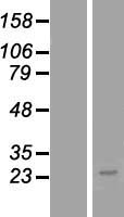 ls374395 tmem179b human over expression lysates nm 199337 wb testing 1
