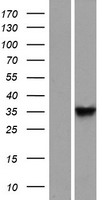 DNAJB13 Human Over-expression Lysates NM_153614