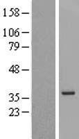 ls374408 mgc12965 human over expression lysates nm 198519 wb testing 1
