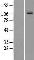 KIF7 Human Over-expression Lysates NM_198525