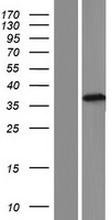 ls374739 tepp human over expression lysates nm 199046 wb testing 1